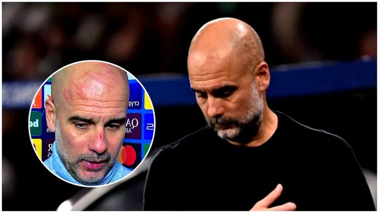 S-a aflat! Motivul incredibil pentru care Pep Guardiola a venit cu răni pe față la interviu: „Cu o zi în urmă, a avut o ceartă” Fanatik.ro” „prefix”:”@ 